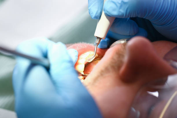 Best Emergency Treatment for Toothache in Voorheesville, NY