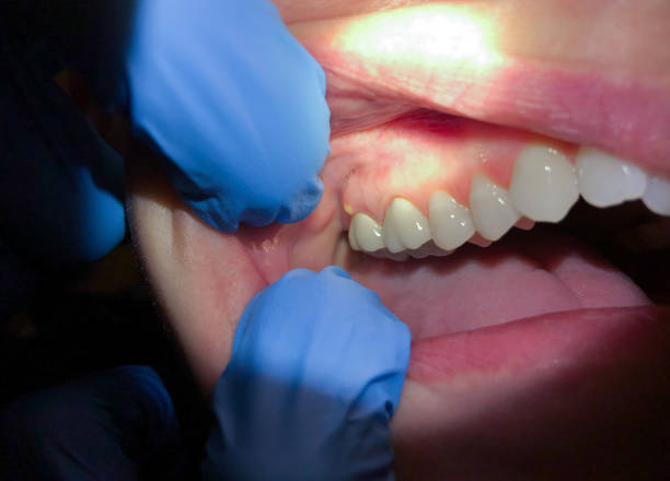 Best Walk-In Emergency Dentist in Voorheesville, NY