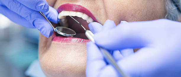 Best Emergency Treatment for Toothache in Voorheesville, NY